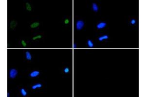 Immunofluorescence of Rabbit Anti-Histone H3 [ac Lys18] Antibody. (Histone 3 antibody  (H3K18ac))