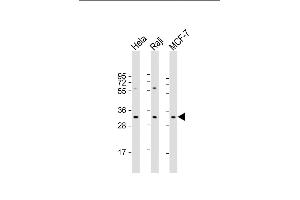 All lanes : Anti-IP Antibody (Center) at 1:2000 dilution Lane 1: Hela whole cell lysate Lane 2: Raji whole cell lysate Lane 3: MCF-7 whole cell lysate Lysates/proteins at 20 μg per lane. (APIP antibody  (AA 111-142))