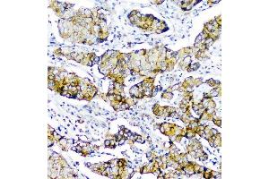 IHC analysis of CD2AP using anti-CD2AP antibody (ABIN6719544).