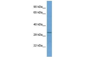 Host:  Rabbit  Target Name:  RNF150  Sample Type:  Jurkat Whole cell lysates  Antibody Dilution:  1. (RNF150 antibody  (C-Term))