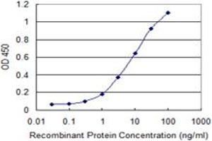 Detection limit for recombinant GST tagged TWIST1 is 0. (TWIST1 antibody  (AA 106-174))