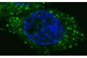 Immunofluorescence (IF) image for anti-Met Proto-Oncogene (MET) antibody (ABIN2995277)