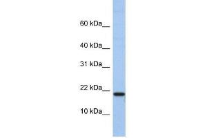 C1D antibody used at 0. (C1D antibody  (N-Term))