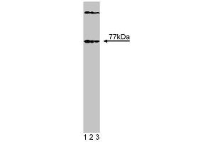 Western blot analysis of Btk on EB1 lysate. (BTK antibody  (N-Term))