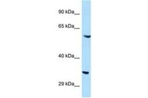 Image no. 1 for anti-GTPase, IMAP Family Member 4 (GIMAP4) (AA 253-302) antibody (ABIN6747355) (GIMAP4 antibody  (AA 253-302))