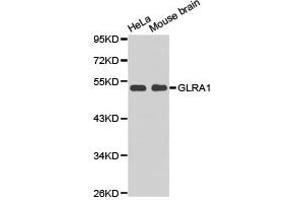 Western Blotting (WB) image for anti-Glycine Receptor, alpha 1 (GLRA1) antibody (ABIN1872831)