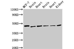 Western Blot Positive WB detected in: MCF-7 whole cell lysate, Rat brain tissue, Rat heart tissue, Mouse brain tissue, Mouse heart tissue, Mouse kidney tissue All lanes: DKC1 antibody at 2. (DKC1 antibody  (AA 94-170))