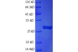 SDS-PAGE (SDS) image for RAB3A Interacting Protein (Rabin3)-Like 1 (RAB3IL1) (AA 21-247) protein (His tag) (ABIN5709635) (RAB3IL1 Protein (AA 21-247) (His tag))