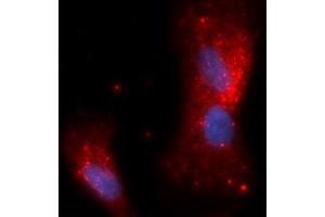 Immunofluorescence (IF) image for anti-Complement Factor Bb antibody (APC) (ABIN5564989) (Complement Factor Bb antibody  (APC))