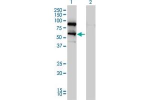 Western Blot analysis of DDX41 expression in transfected 293T cell line by DDX41 monoclonal antibody (M01), clone 2F4. (DDX41 antibody  (AA 523-622))