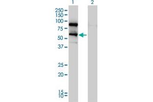 Western Blot analysis of DDX41 expression in transfected 293T cell line by DDX41 monoclonal antibody (M01), clone 2F4.
