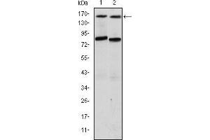 Western blot analysis using AIB1 mouse mAb against T47D (1) and MCF-7 (2) cell lysate. (NCOA3 antibody)
