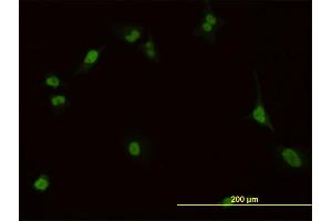 Immunofluorescence of monoclonal antibody to PBX1 on HeLa cell. (PBX1 antibody  (AA 213-321))