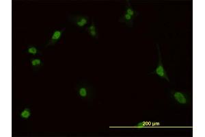 Immunofluorescence of monoclonal antibody to PBX1 on HeLa cell.