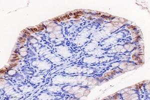 Immunohistochemistry analysis of paraffin-embedded mouse colon using,FGF10 (ABIN7073940) at dilution of 1: 8000