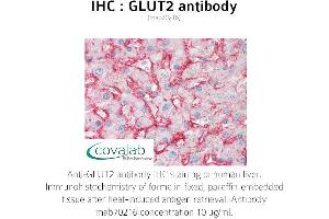 Image no. 1 for anti-Solute Carrier Family 2 (Facilitated Glucose Transporter), Member 2 (SLC2A2) antibody (ABIN1723156) (SLC2A2 antibody)