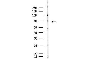 Western blot analysis of lysates from Rat brain, using ME Antibody at 1/1000 dilution.