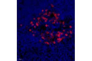 Immunofluorescence of paraffin embedded rat thymus using PTPN2 (ABIN7075295) at dilution of 1:500 (400x lens)