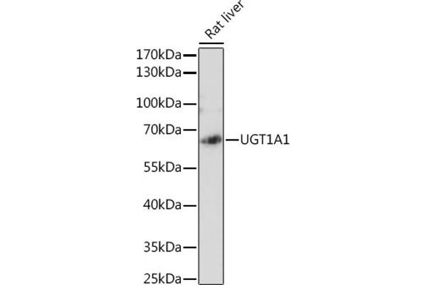 UGT1A1 antibody  (AA 1-200)