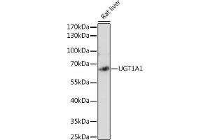 Western blot analysis of extracts of Rat liver, using UGT1 antibody (ABIN6132769, ABIN6149895, ABIN6149896 and ABIN6221779) at 1:2130 dilution.