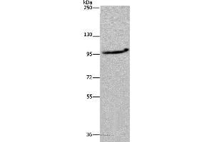 Western blot analysis of LO2 cell, using MAP3K11 Polyclonal Antibody at dilution of 1:400