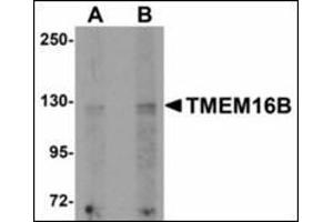 Western blot analysis of TMEM16B in rat brain tissue lysate with TMEM16B antibody at (A) 1 and (B) 2 µg/ml. (Anoctamin 2 antibody  (N-Term))