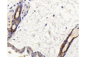Immunohistochemistry analysis of paraffin-embedded mouse skin using CK-17 Polyclonal Antibody at dilution of 1:400. (KRT17 antibody)
