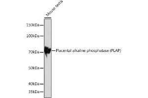 Western blot analysis of extracts of Mouse testis, using Placental alkaline phosphatase (PLAP) Rabbit mAb (ABIN1682693, ABIN7101664, ABIN7101665 and ABIN7101666) at 1:1000 dilution. (PLAP antibody)