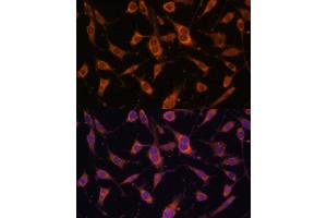 Immunofluorescence analysis of L929 cells using FBLN5 Polyclonal Antibody (ABIN6127927, ABIN6140497, ABIN6140498 and ABIN6225300) at dilution of 1:100 (40x lens). (Fibulin 5 antibody  (AA 199-448))