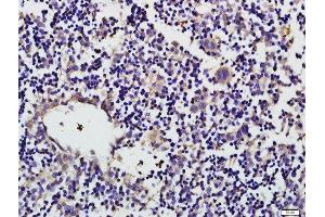 Paraformaldehyde-fixed, paraffin embedded mouse fetal liver tissue, Antigen retrieval by boiling in sodium citrate buffer(pH6) for 15min, Block endogenous peroxidase by 3% hydrogen peroxide for 30 minutes, Blocking buffer (normal goat serum) at 37°C for 20min, Antibody incubation with CD19 (Tyr531) Polyclonal Antibody, Unconjugated  at 1:500 overnight at 4°C, followed by a conjugated secondary and DAB staining (CD19 antibody  (pTyr531))
