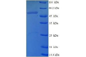 SDS-PAGE (SDS) image for DIM1 Dimethyladenosine Transferase 1 Homolog (DIMT1) (AA 1-313), (full length) protein (His-SUMO Tag) (ABIN5711967)