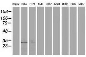 Image no. 2 for anti-Eukaryotic Translation Initiation Factor 4E Family Member 2 (EIF4E2) antibody (ABIN1497993)