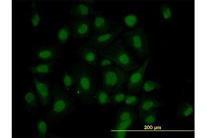 Immunofluorescence of monoclonal antibody to HIPK1 on HeLa cell. (HIPK1 antibody  (AA 330-430))