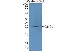 Detection of Recombinant COL16, Human using Polyclonal Antibody to Collagen Type XVI (COL16) (COL16 antibody  (AA 1434-1604))