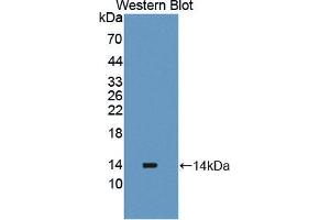 Western blot analysis of the recombinant protein. (PLOD2 antibody  (AA 644-737))