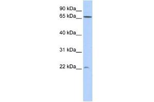 DIRAS1 antibody used at 1 ug/ml to detect target protein. (DIRAS1 antibody  (N-Term))
