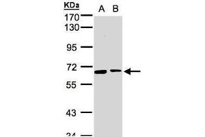 WB Image Sample(30 ug whole cell lysate) A:293T B:MOLT4 , 7. (SENP2 antibody  (N-Term))