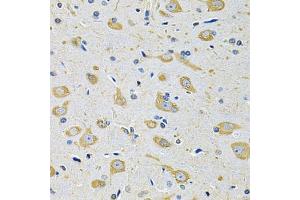 Immunohistochemistry of paraffin-embedded mouse brain using FASTKD1 Antibody (ABIN5975129) at dilution of 1/100 (40x lens). (FASTKD1 antibody)