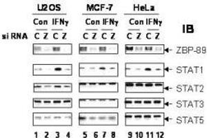 Image no. 1 for anti-Zinc Finger Protein 148 (ZNF148) antibody (ABIN299225) (ZNF148 antibody)