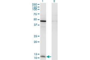 Western Blot analysis of CCL2 expression in transfected 293T cell line by CCL2 monoclonal antibody (M05), clone 1F10. (CCL2 antibody  (AA 1-99))
