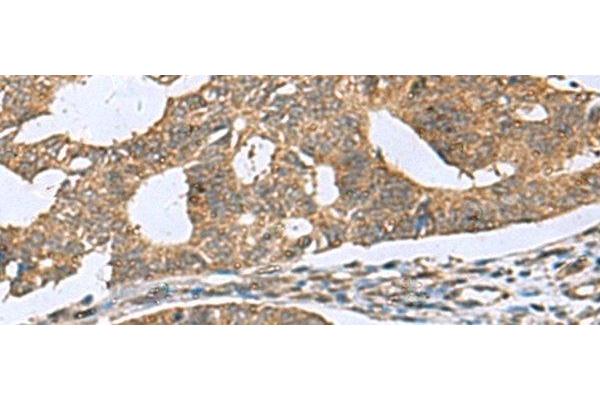 RPL18 antibody