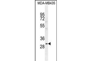 CLEC10A Antibody (N-term) (ABIN654515 and ABIN2844239) western blot analysis in MDA-M cell line lysates (35 μg/lane). (CLEC10A antibody  (N-Term))