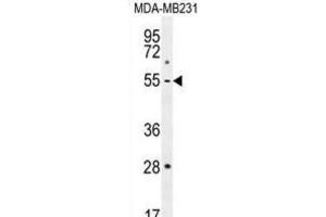 Western Blotting (WB) image for anti-Matrix Metallopeptidase 1 (Interstitial Collagenase) (MMP1) antibody (ABIN2996416) (MMP1 antibody)