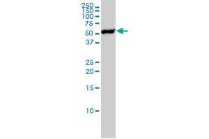 YES1 monoclonal antibody (M02), clone 3C6 Western Blot analysis of YES1 expression in Jurkat . (YES1 antibody  (AA 1-80))