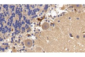 Immunohistochemistry (IHC) image for anti-alpha-2-Macroglobulin (A2M) (AA 616-856) antibody (ABIN7429073)