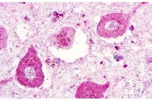 Image no. 1 for anti-Purinergic Receptor P2Y, G-Protein Coupled, 1 (P2RY1) (C-Term) antibody (ABIN1049201) (P2RY1 antibody  (C-Term))