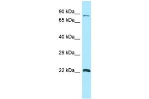 WB Suggested Anti-GPSM1 Antibody Titration: 1. (GPSM1 antibody  (C-Term))