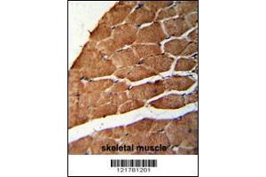 Formalin-fixed and paraffin-embedded human skeletal muscle reacted with CCHCR1 Antibody , which was peroxidase-conjugated to the secondary antibody, followed by DAB staining.