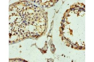 Immunohistochemistry of paraffin-embedded human testis tissue using ABIN7173683 at dilution of 1:100 (TUBB3 antibody  (AA 1-210))