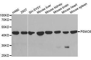 Western blot analysis of extracts of various cell lines, using PSMC6 antibody. (PSMC6 antibody)